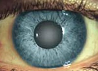 Катаракта и глаукома - лечение и профилактика